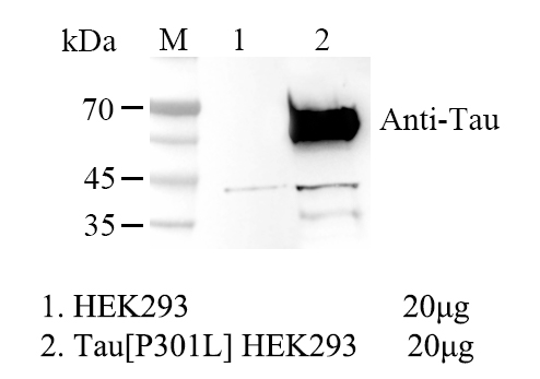 HEK293 Human Tau [P301L] Cell